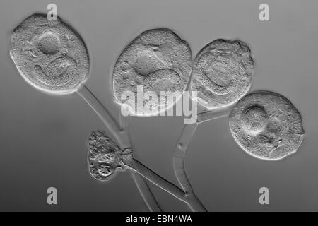 (Vorticella Vorticella spec.), contraste d'interférence différentielle Banque D'Images