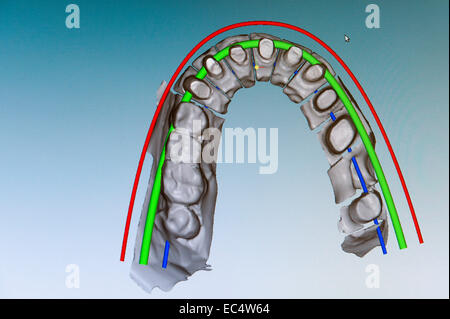 Représentation de la mâchoire supérieure modèle sur le moniteur Banque D'Images