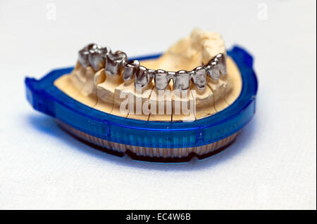 Châssis métal fini pour les couronnes en céramique Banque D'Images