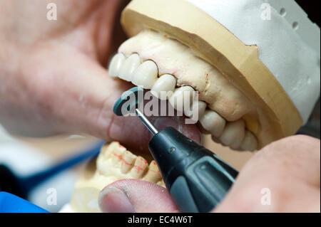 Les boucles de correction des couronnes en céramique au fini Banque D'Images