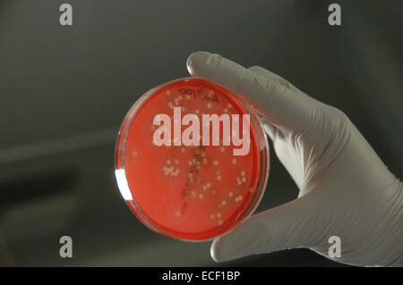 Les bactéries de la peau humaine cultivée sur agar dans le laboratoire. Banque D'Images