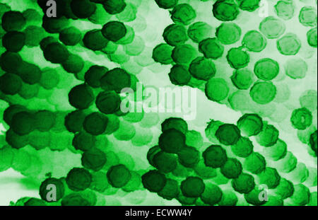 Micrographe de champignons Aspergillus conidiospores. Banque D'Images