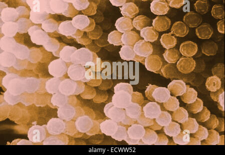 Micrographe de champignons Aspergillus conidiospores. Banque D'Images