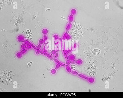 Micrographe de Candida de chlamydospores. Banque D'Images