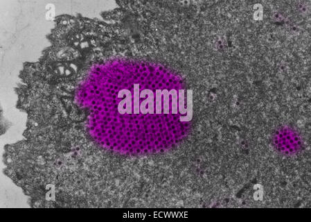 Image au microscope électronique d'adénovirus canins. Banque D'Images