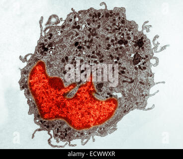 Micrographe de macrophages canins dans les tissus pulmonaires. Banque D'Images