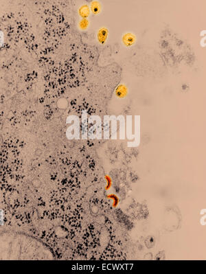 Micrographie électronique à transmission du VIH-1 en herbe, et gratuitement. Banque D'Images