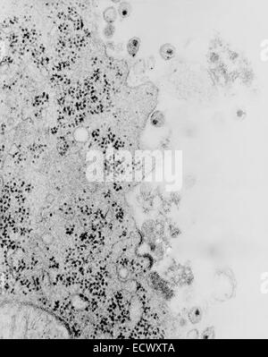 Micrographie électronique à transmission du VIH-1 en herbe, et gratuitement. Banque D'Images