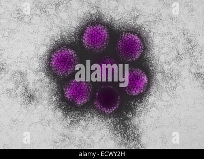 Micrographe de l'adénovirus canin de type 1 (CAV-1). Banque D'Images