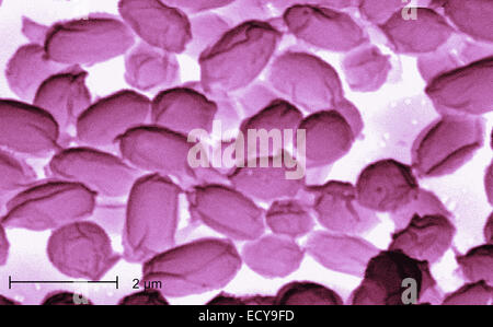 Photomicrographie de Bacillus anthracis (anthrax) spores. Banque D'Images