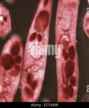 Photomicrographie de Bacillus anthracis (anthrax) spores. Banque D'Images