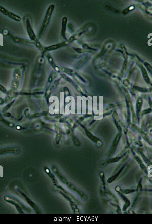 Photomicrographie de Bacillus anthracis (anthrax) spores. Banque D'Images