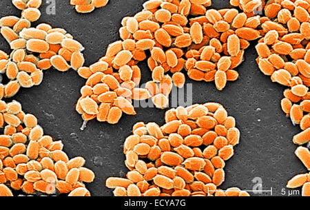 Photomicrographie de Bacillus anthracis (anthrax) spores. Banque D'Images