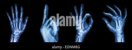 Collection X-ray mains symbole Banque D'Images