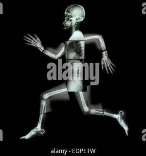L'exercice aérobie (droits de l'os est en marche) ,(corps entier x-ray : tête, cou, épaule, bras, épaule, coude, avant-bras, main, doigt Banque D'Images