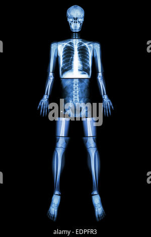 Position anatomique. (X-ray ensemble du corps : tête, cou, thorax, coeur, poumons, côtes, épaule, bras, avant-bras, omoplate coude, poignet ,ha , Banque D'Images