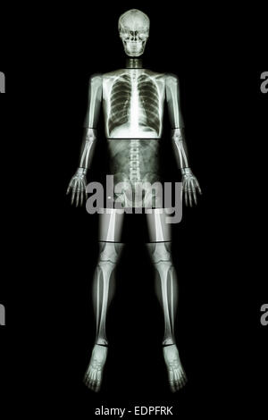 Position anatomique. (X-ray ensemble du corps : tête, cou, thorax, coeur, poumons, côtes, épaule, bras, avant-bras, omoplate coude, poignet ,ha , Banque D'Images