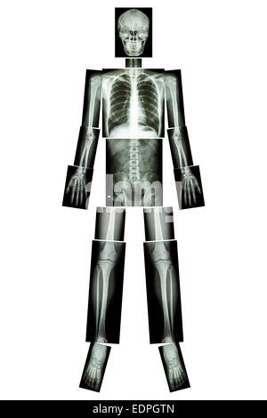 Position anatomique. (X-ray ensemble du corps : tête, cou, thorax, coeur, poumons, côtes, épaule, bras, avant-bras, omoplate coude, poignet ,ha , Banque D'Images