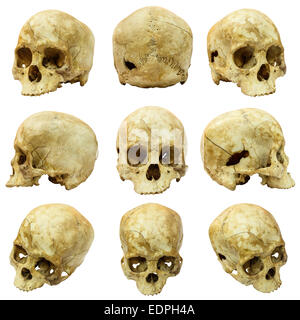 Collection de crâne humain (Mongoloïdes) et Broken Skull Banque D'Images