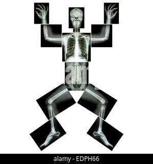 Les puzzle x-ray ( corps entier : tête crâne visage cou épaule dos coude poignet du bras avant-bras main doigt thorax poitrine hea Banque D'Images