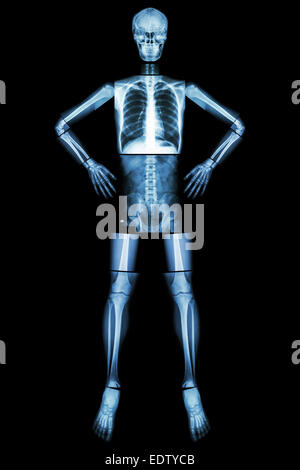 Stand d'os humains et akimbo (X-ray corps entier : tête crâne rachis cou épaule coude poignet du bras avant-bras main doigt thorax thorax Banque D'Images