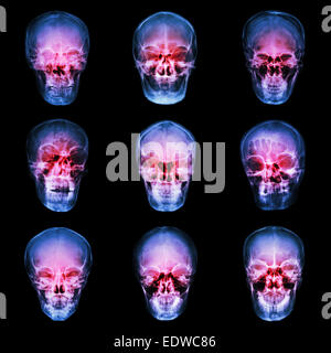 Collection de crâne de l'asiatique Banque D'Images