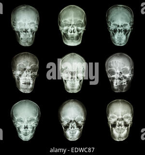 Collection de crâne de l'asiatique Banque D'Images