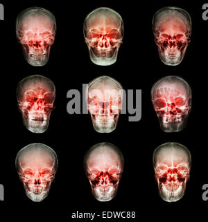 Collection de crâne de l'asiatique Banque D'Images