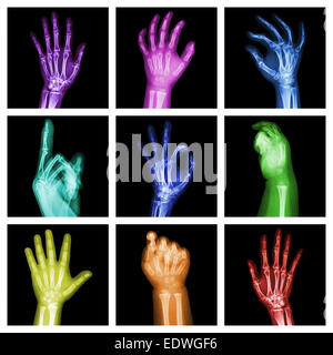 Collection de x-ray mains colorés Banque D'Images