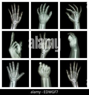 Collection x-ray de mains Banque D'Images