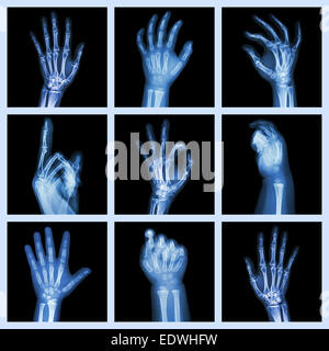 Collection x-ray de mains Banque D'Images