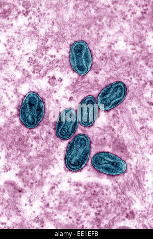 VIRUS DE LA SHARKA, TEM Banque D'Images