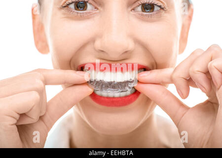 Closeup portrait of charming woman silicone orthodontique trainer Banque D'Images