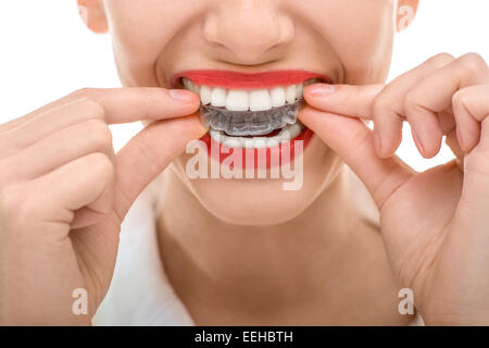 Closeup portrait of charming woman silicone orthodontique trainer Banque D'Images