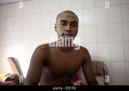 Dhaka, Bangladesh. 5 Février, 2015. Tanveer, l'une des victimes de l'essence sur un bus cris de douleur quand il reçoit un traitement à la Dhaka Medical College Hospital à Dhaka, Bangladesh, le Jeudi, Février 5, 2015. Les attaquants ont lancé des bombes sur un feu de pétrole brut paniers autobus avant mardi matin, l'incident s'est produit dans la région de Comilla Choudyagram. La bombe incendiaire a été signalé sur l'autoroute de l'Dhaka-Chittagong autour de 3h30 au cœur de la BNP en cours et les trois blocus transport grève nationale de jour. Credit : ZUMA Press, Inc./Alamy Live News Banque D'Images