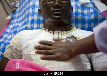 Dhaka, Bangladesh. 5 Février, 2015. Shafiqul Islam, 18, l'une des victimes de l'essence sur un bus cris de douleur quand il reçoit un traitement à la Dhaka Medical College Hospital à Dhaka, Bangladesh, le Jeudi, Février 5, 2015. Les attaquants ont lancé des bombes sur un feu de pétrole brut paniers autobus avant mardi matin, l'incident s'est produit dans la région de Comilla Choudyagram. La bombe incendiaire a été signalé sur l'autoroute de l'Dhaka-Chittagong autour de 3h30 au cœur de la BNP en cours et les trois blocus transport grève nationale de jour. Credit : ZUMA Press, Inc./Alamy Live News Banque D'Images