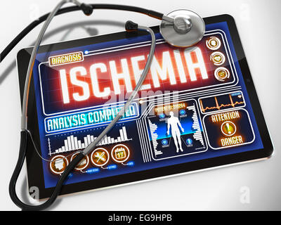 Diagnostic de l'ischémie - sur l'affichage de la tablette médicale et d'un stéthoscope noir sur fond blanc. Banque D'Images