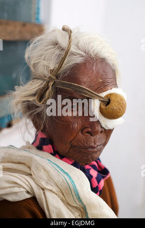 L'Inde en 2014. Le Bihar. La mission chrétienne, de l'hôpital Bamdah. Un patient attend pour Dr Samuel d'effectuer la chirurgie de la cataracte. Banque D'Images