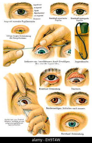 Diverses maladies de l'œil, conseiller de la santé, 19e siècle, Banque D'Images