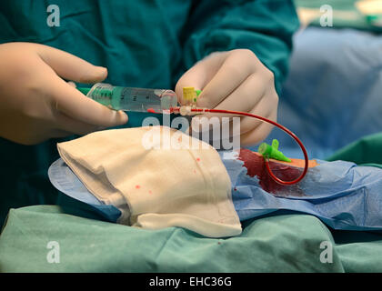 Procédure d'ablation par cathéter au Centre clinique universitaire Sister of Mercy à Zagreb, Croatie Banque D'Images