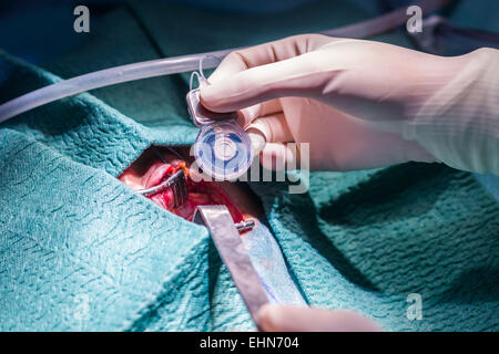 Les chirurgien implant cochléaire, une opération d'implantation d'un petit appareil électronique utilisé pour donner une idée de son à une personne sourde, de l'hôpital de Limoges, France. Banque D'Images