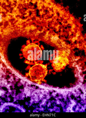 Micrographe de couleur (TEM) d'un coronavirus MERS , Panneaux de particules - aggloméré ce virus (initialement nouveau coronavirus en 2012) a été nommé le syndrome respiratoire du Moyen-Orient (MERS) coronavirus. Banque D'Images