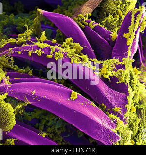 Yersinia pestis bactéries qui s'étaient rassemblés sur le dos d'un proventricular Xenopsylla cheopis flea. Y. pestis bactérie est l'agent pathogène qui cause la peste bubonique, l'analyse des électrons Microphotographie (SEM). Banque D'Images