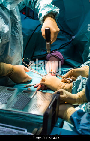 Vis de pose et la plaque sur le bras d'un patient. Banque D'Images