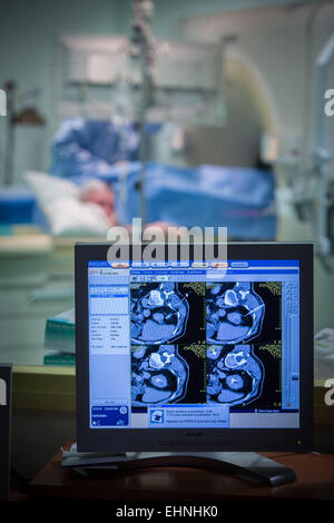 Tomodensitométrie assistée de la cryothérapie pour détruire une tumeur rénale, hôpital Saint-Louis, Paris, France. Banque D'Images