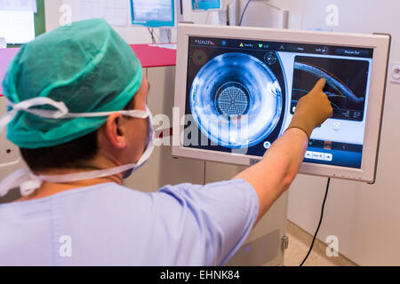 La chirurgie de la cataracte au laser femtoseconde. Département d'Ophtalmologie de l'hôpital de Bordeaux, France. Banque D'Images