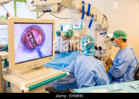 La chirurgie de la cataracte, l'installation de l'implant intraoculaire, l'hôpital de Bordeaux, France. Banque D'Images