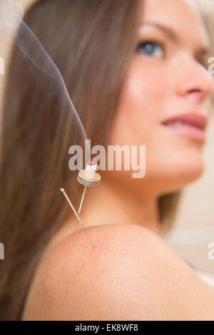 La moxibustion aiguilles acupunture sur chaleur femme Banque D'Images