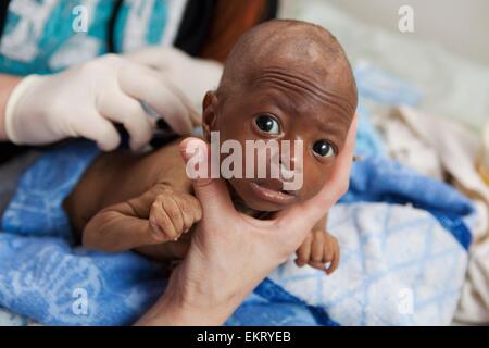 Un enfant en train de mourir du VIH/sida qui sont pris en charge par le personnel médical ; Manica, Mozambique, Africa Banque D'Images