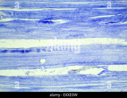 Le tissu musculaire squelettique section longitudinale sous un microscope, muscle squelettique L.S., 400x Banque D'Images